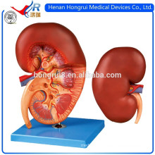 ISO Advanced Medical Kidney Model